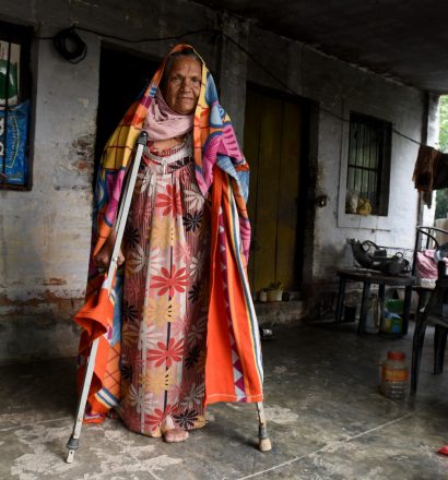 A person affected by leprosy provided with assistive devices for walking