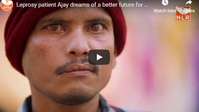 Video still: click to hear the story of Ajay, a person affected by leprosy