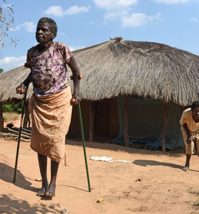 Crutches for woman affected by leprosy
