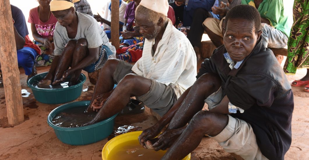 Persons affected by leprosy take care of their feet to prevent infections